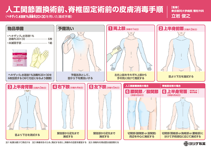 ヘキザック水溶液1％消毒布20×30を用いた人工関節置換術前、脊椎固定術前の皮膚消毒手順